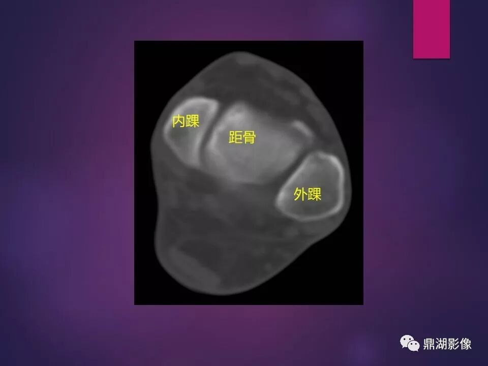 全身骨肌系统正常影像解剖（高清图谱）