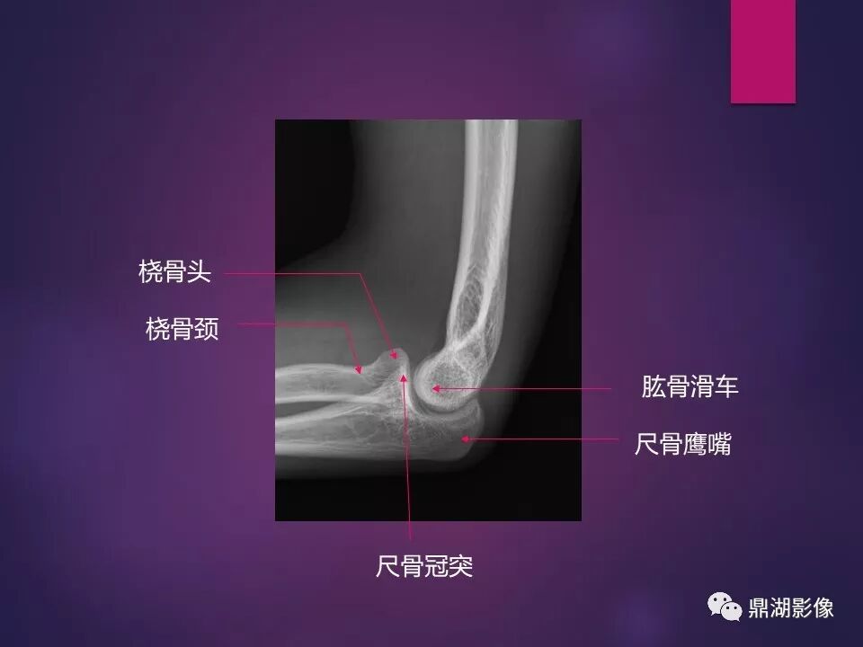 全身骨肌系统正常影像解剖（高清图谱）