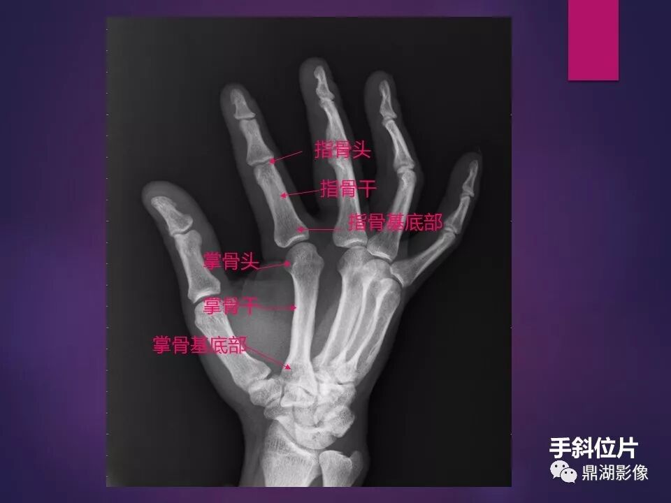 全身骨肌系统正常影像解剖（高清图谱）