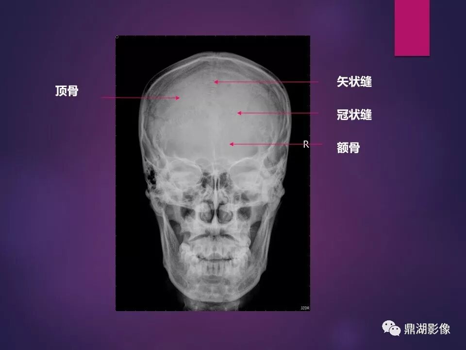 全身骨肌系统正常影像解剖（高清图谱）