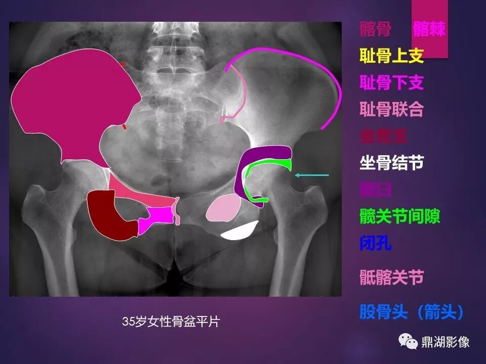 全身骨肌系统正常影像解剖（高清图谱）