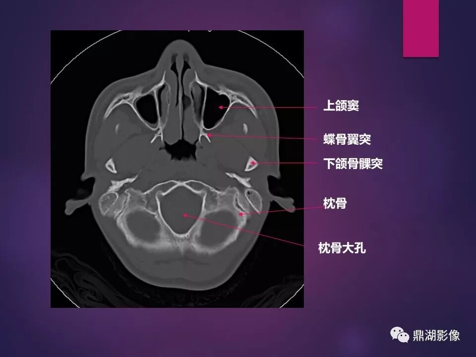 全身骨肌系统正常影像解剖（高清图谱）