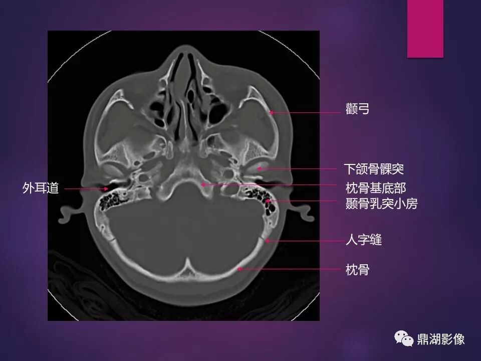 全身骨肌系统正常影像解剖（高清图谱）