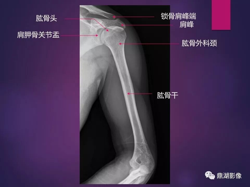 全身骨肌系统正常影像解剖（高清图谱）