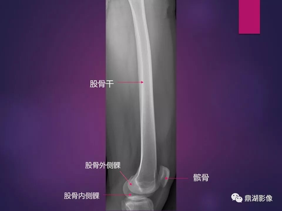 全身骨肌系统正常影像解剖（高清图谱）