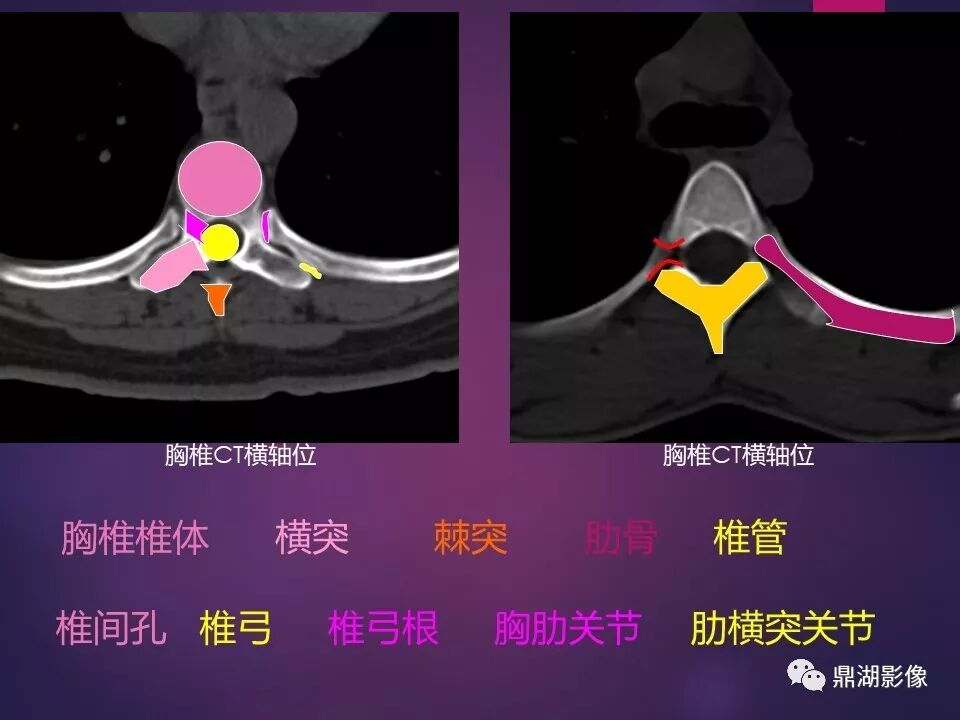 全身骨肌系统正常影像解剖（高清图谱）