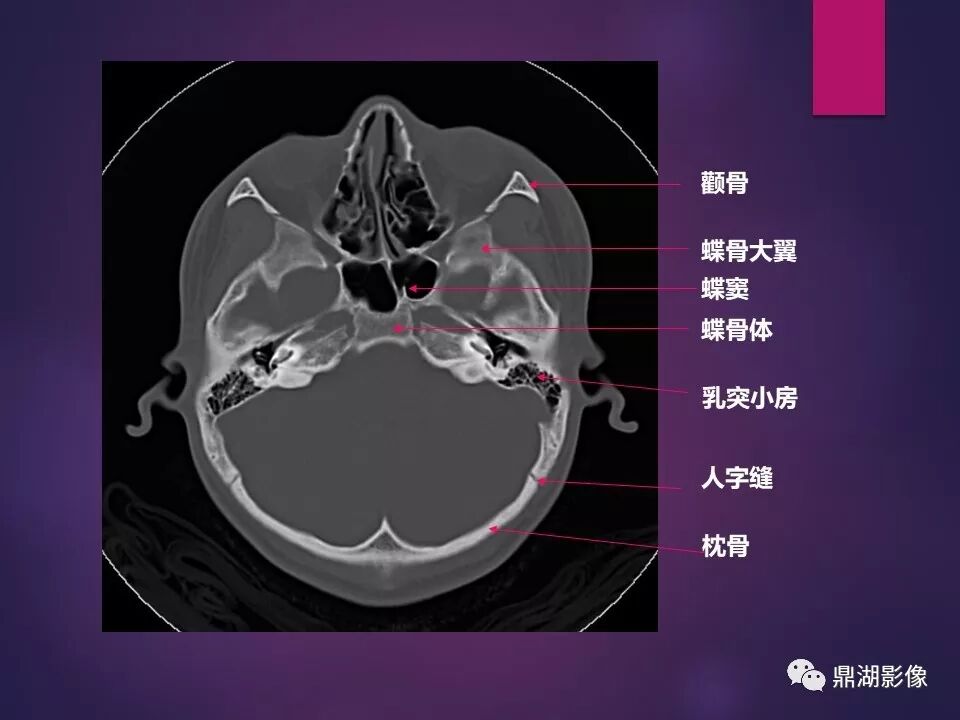 全身骨肌系统正常影像解剖（高清图谱）