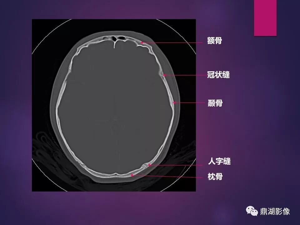 全身骨肌系统正常影像解剖（高清图谱）