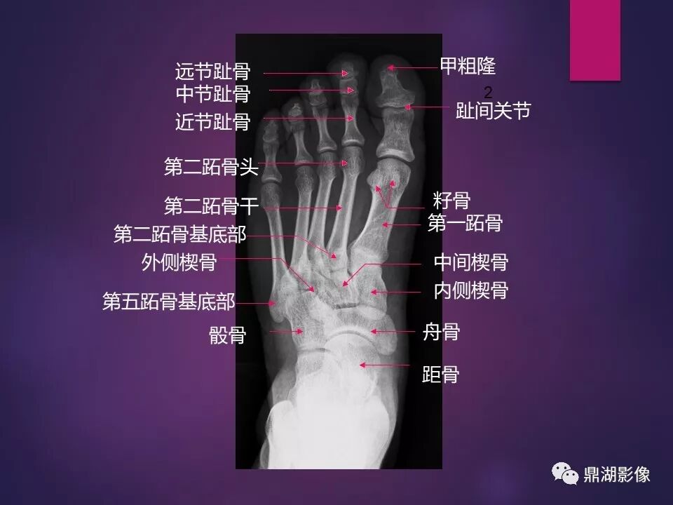 全身骨肌系统正常影像解剖（高清图谱）