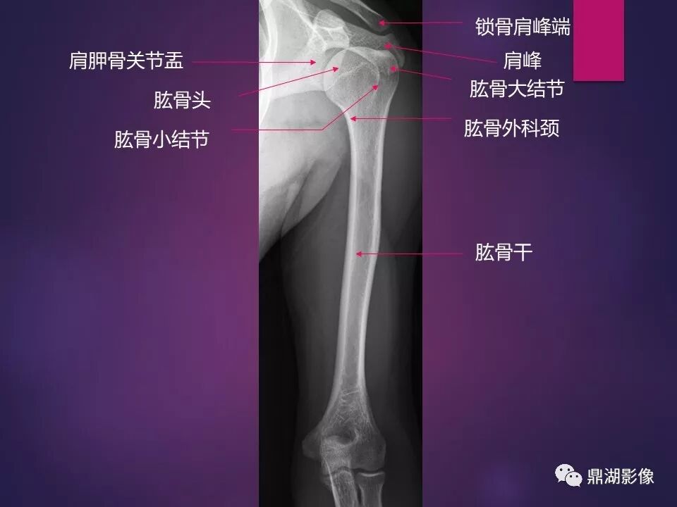 全身骨肌系统正常影像解剖（高清图谱）