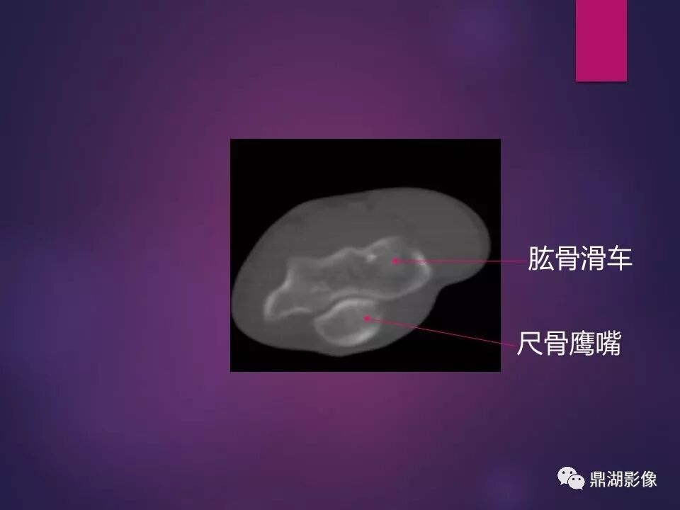 全身骨肌系统正常影像解剖（高清图谱）