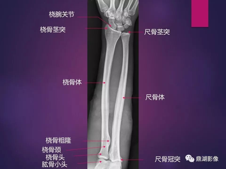 全身骨肌系统正常影像解剖（高清图谱）