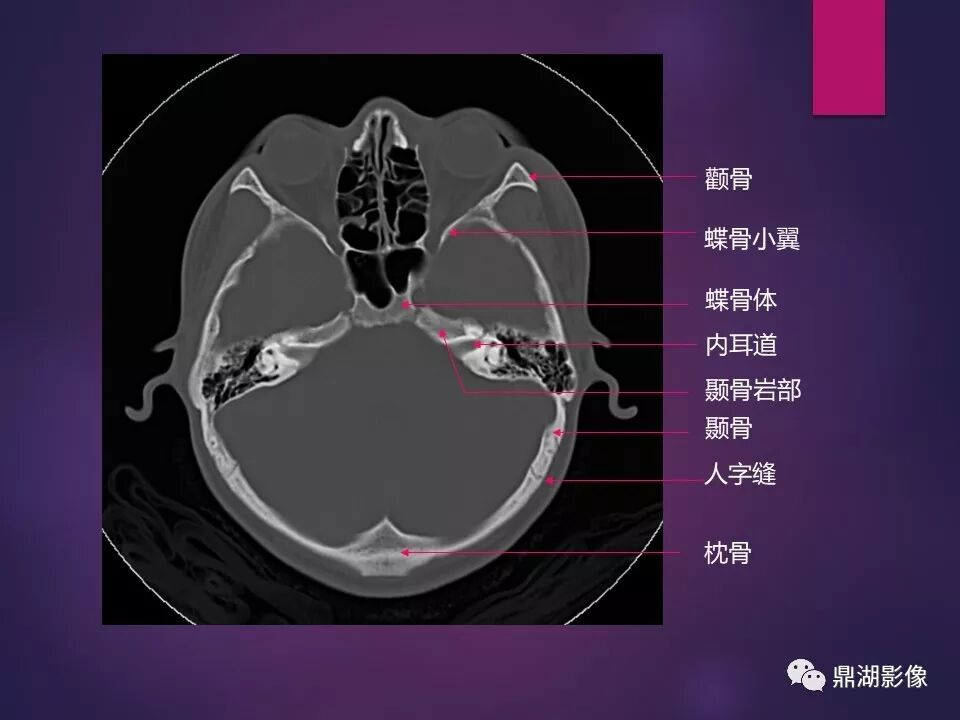 全身骨肌系统正常影像解剖（高清图谱）
