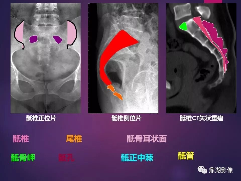 全身骨肌系统正常影像解剖（高清图谱）