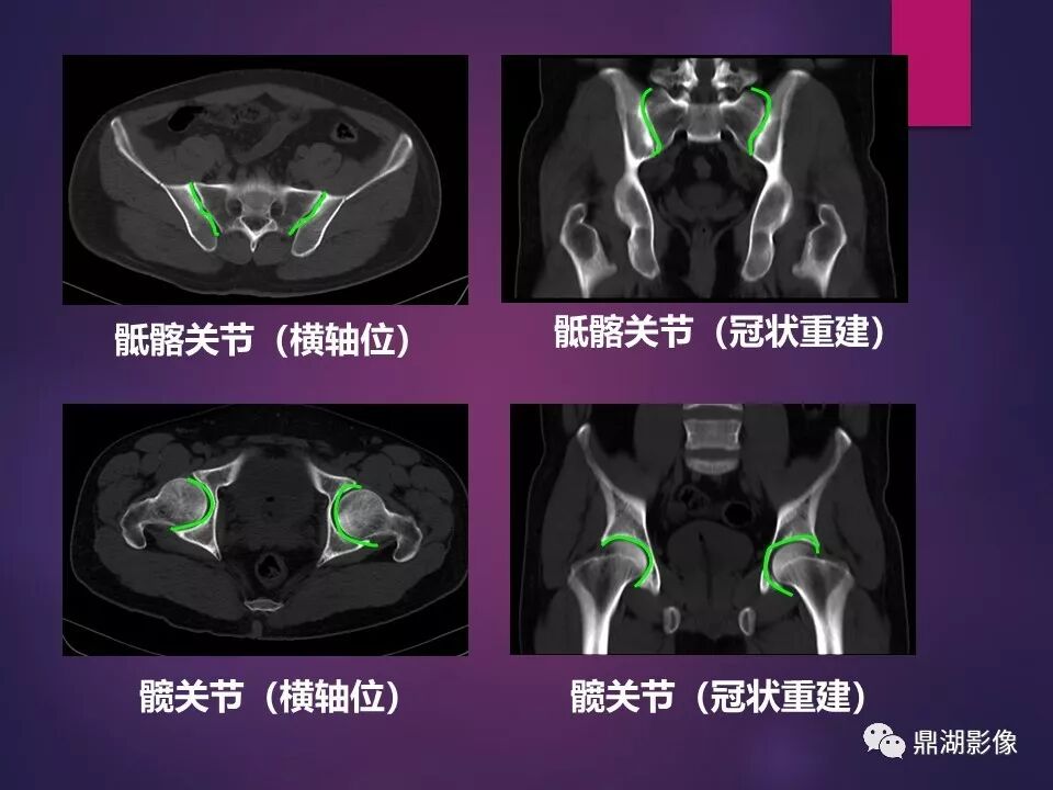 全身骨肌系统正常影像解剖（高清图谱）