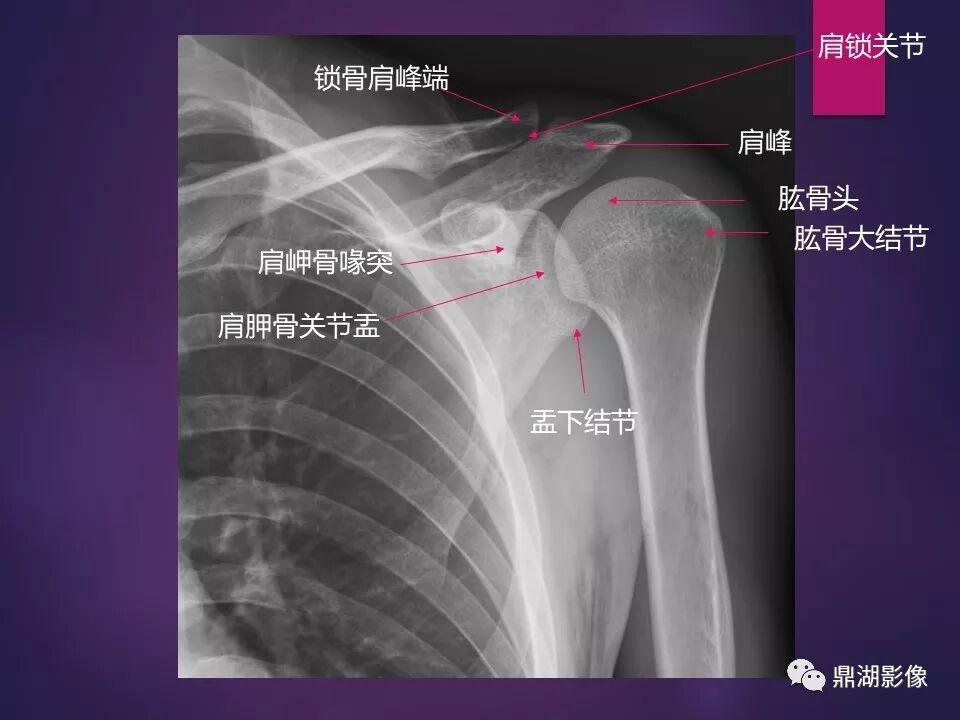 全身骨肌系统正常影像解剖（高清图谱）