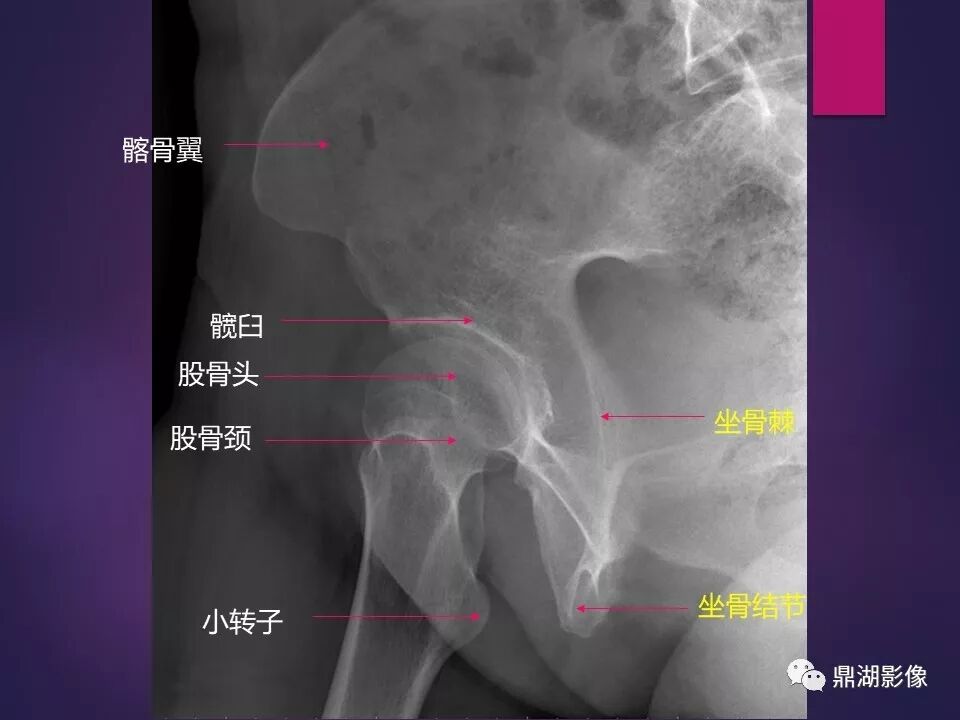 全身骨肌系统正常影像解剖（高清图谱）