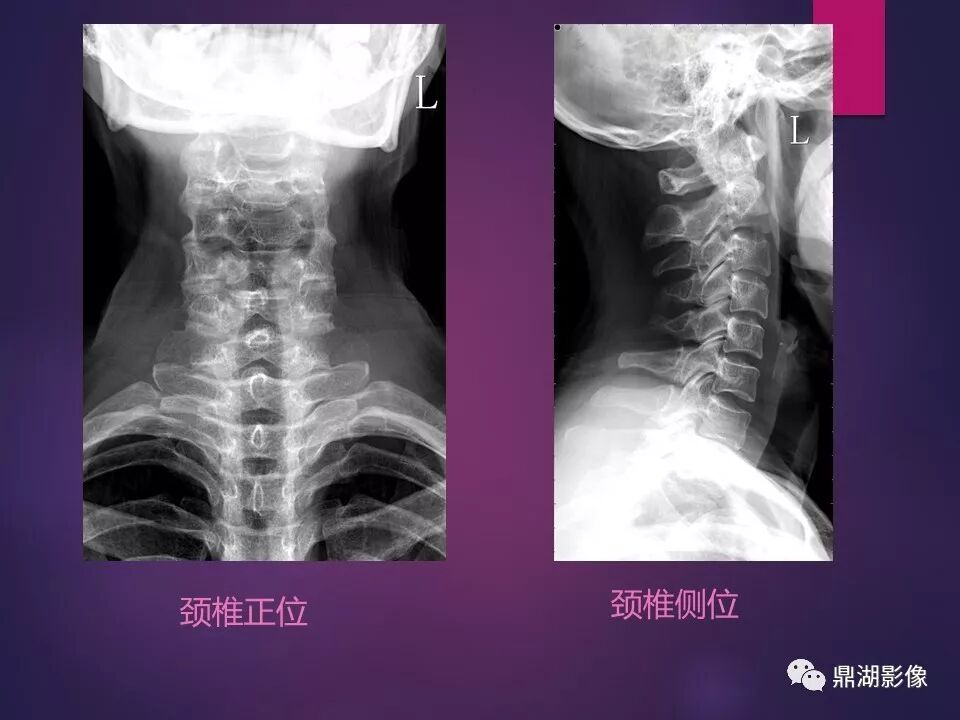 全身骨肌系统正常影像解剖（高清图谱）