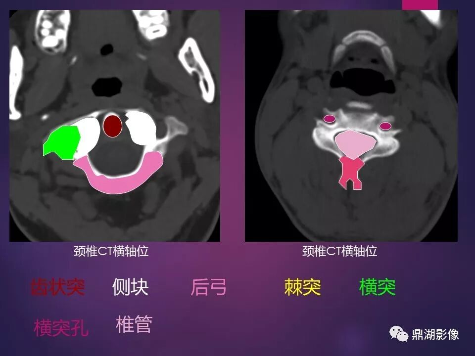 全身骨肌系统正常影像解剖（高清图谱）