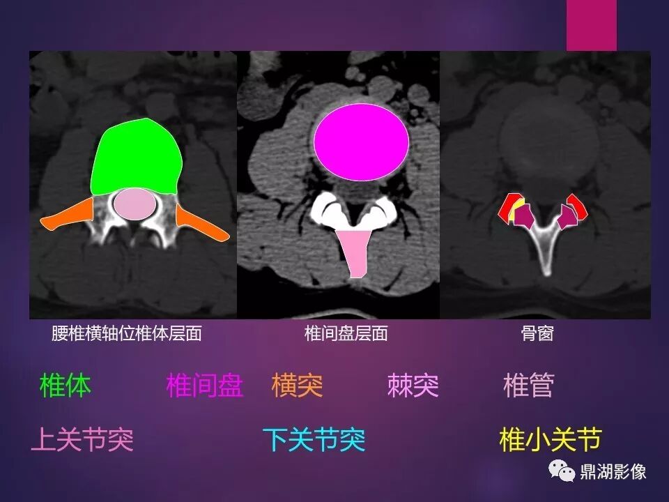 全身骨肌系统正常影像解剖（高清图谱）