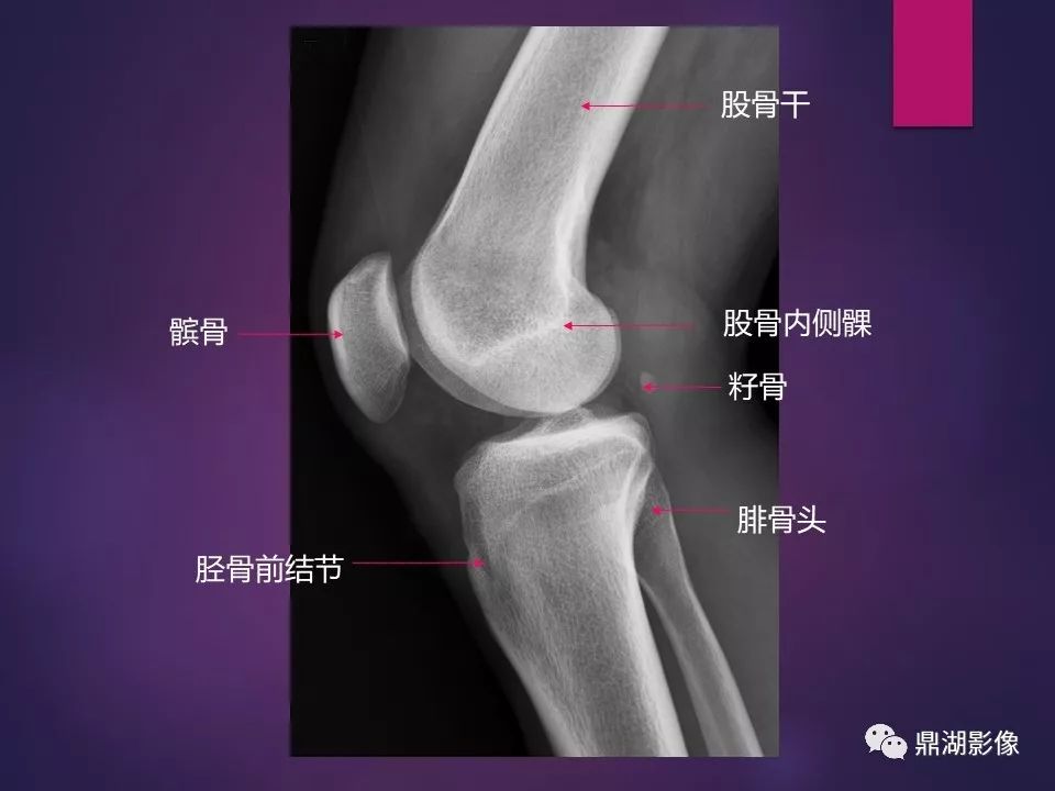 全身骨肌系统正常影像解剖（高清图谱）
