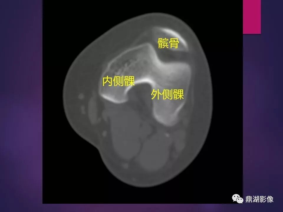 全身骨肌系统正常影像解剖（高清图谱）
