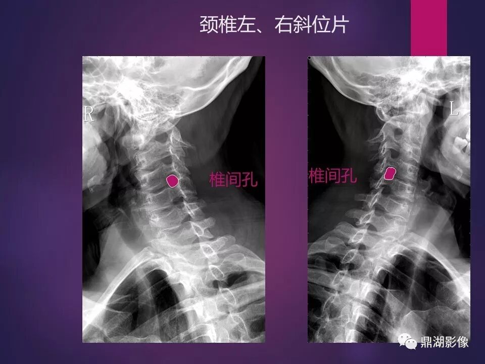全身骨肌系统正常影像解剖（高清图谱）