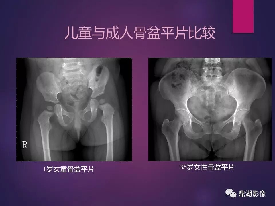 全身骨肌系统正常影像解剖（高清图谱）