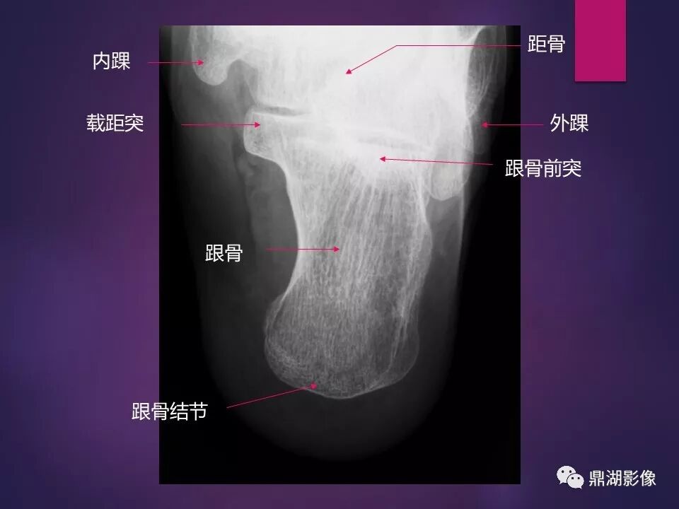 全身骨肌系统正常影像解剖（高清图谱）