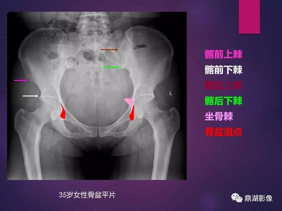 全身骨肌系统正常影像解剖（高清图谱）