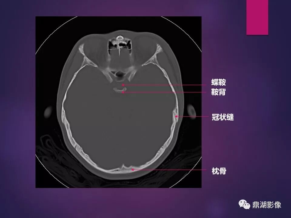 全身骨肌系统正常影像解剖（高清图谱）