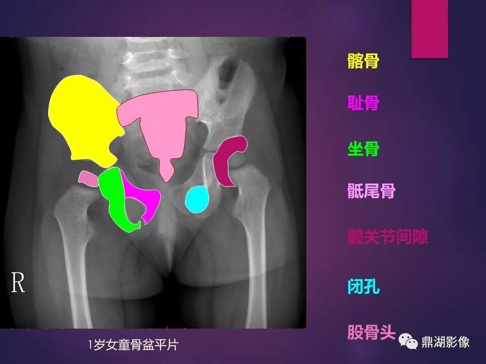 全身骨肌系统正常影像解剖（高清图谱）
