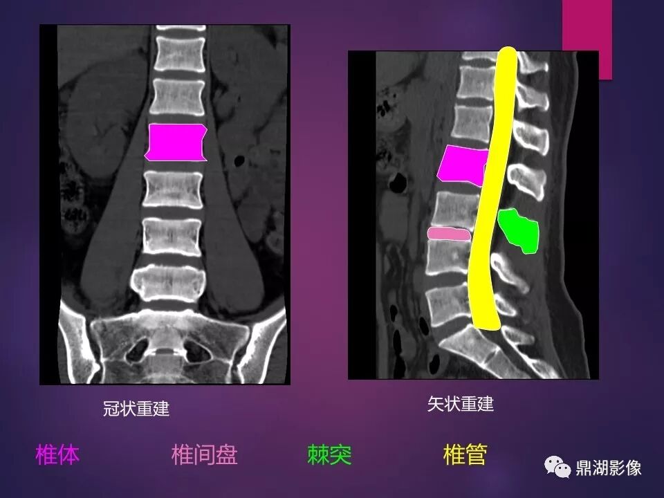 全身骨肌系统正常影像解剖（高清图谱）