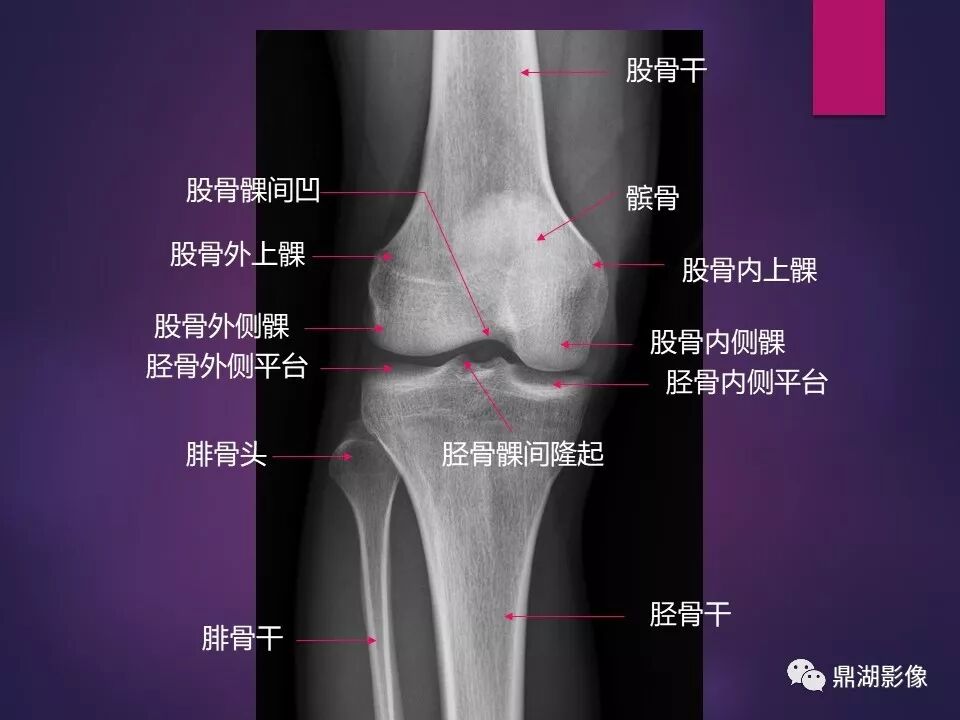 全身骨肌系统正常影像解剖（高清图谱）