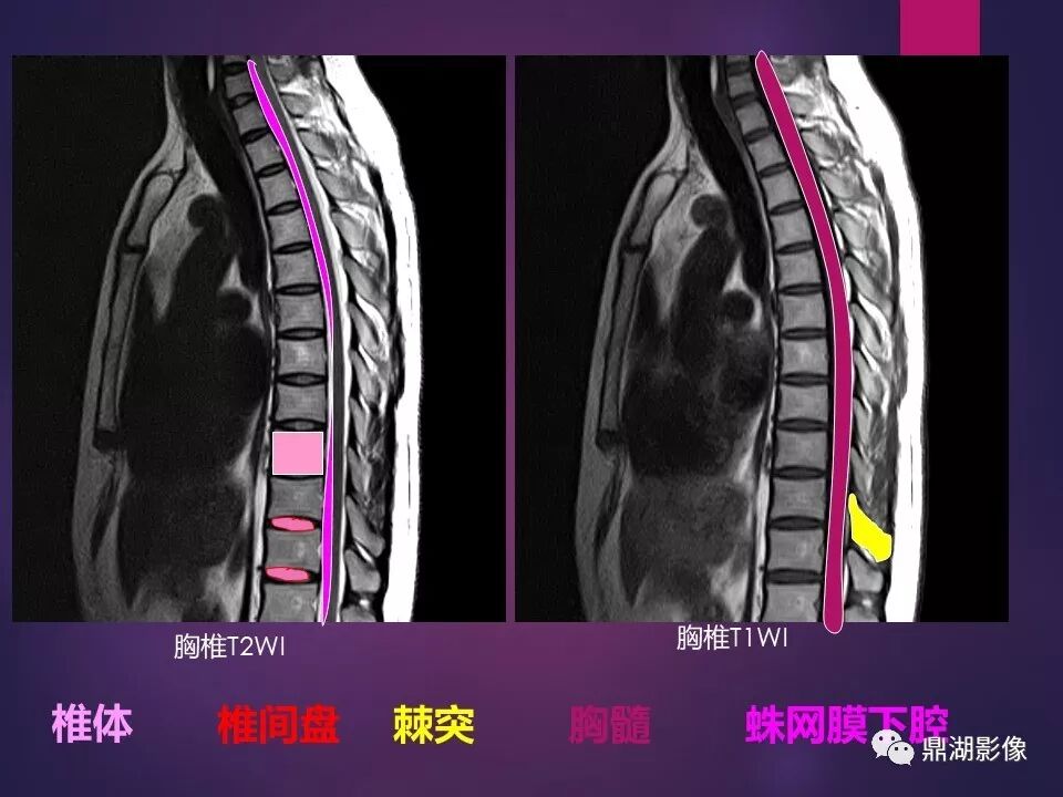 全身骨肌系统正常影像解剖（高清图谱）