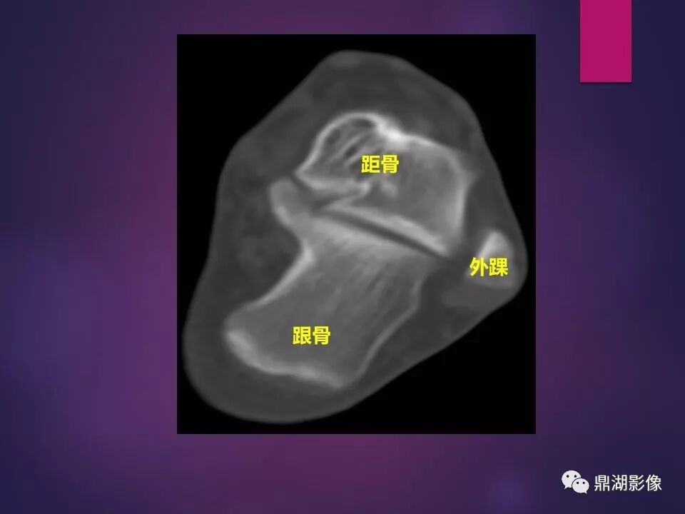 全身骨肌系统正常影像解剖（高清图谱）