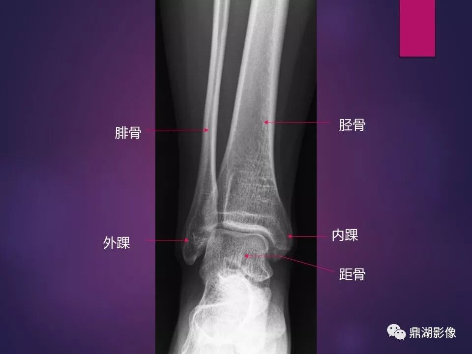 全身骨肌系统正常影像解剖（高清图谱）