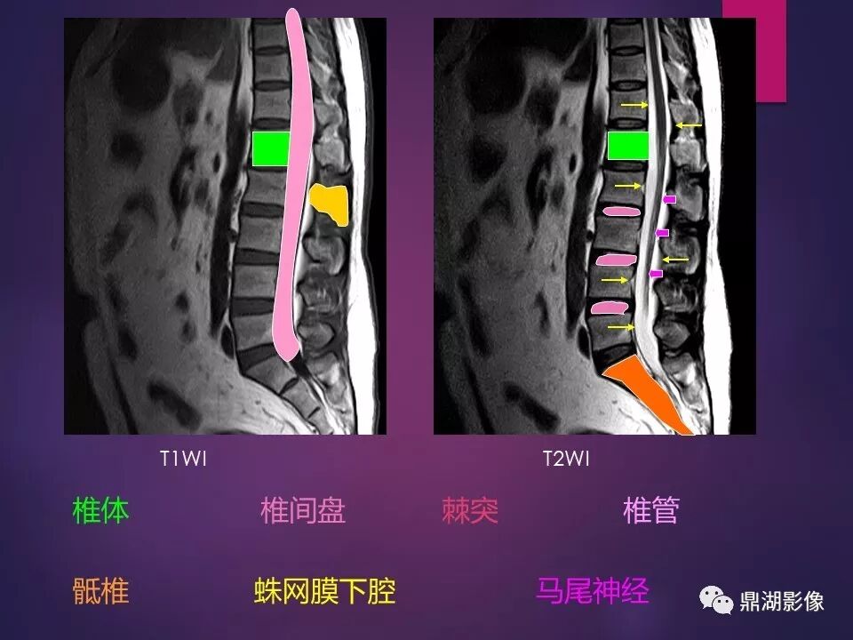 全身骨肌系统正常影像解剖（高清图谱）