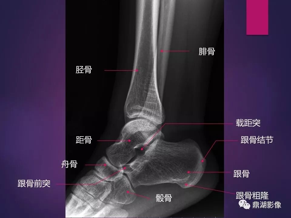 全身骨肌系统正常影像解剖（高清图谱）