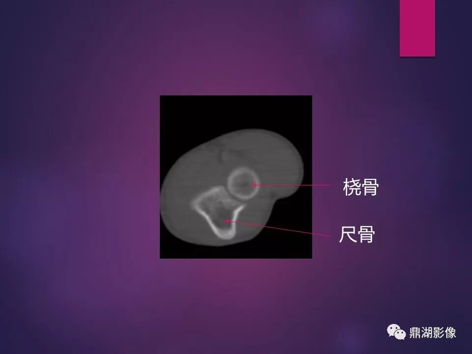 全身骨肌系统正常影像解剖（高清图谱）