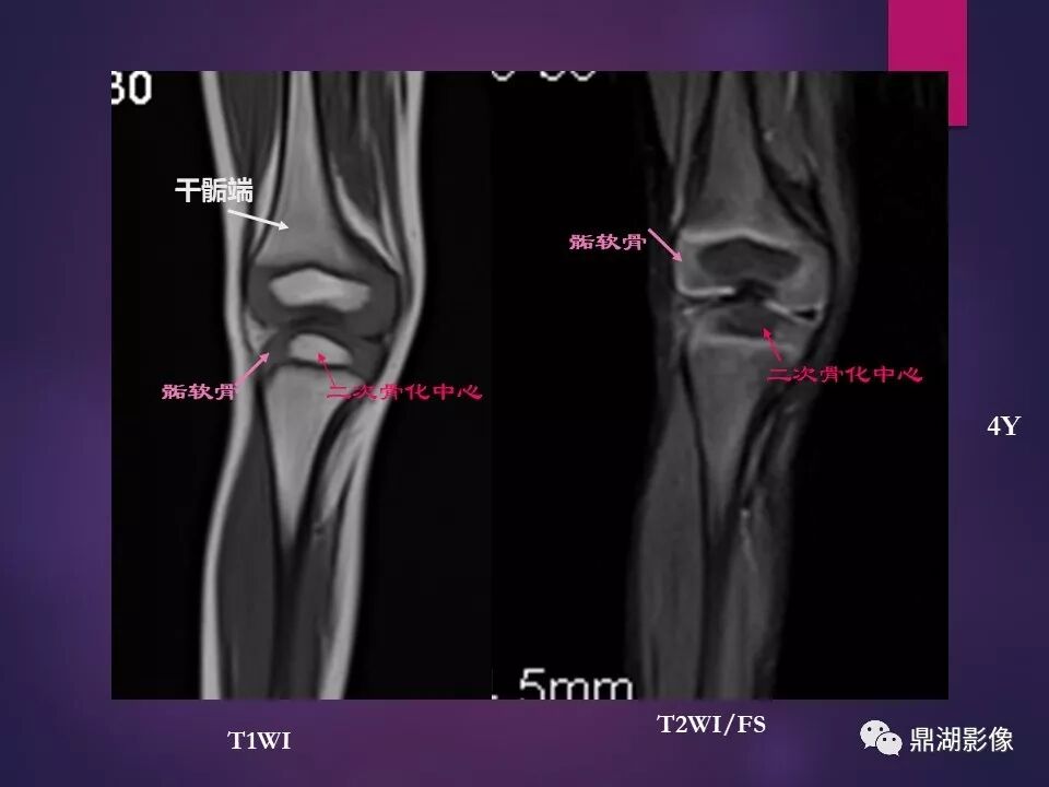 全身骨肌系统正常影像解剖（高清图谱）
