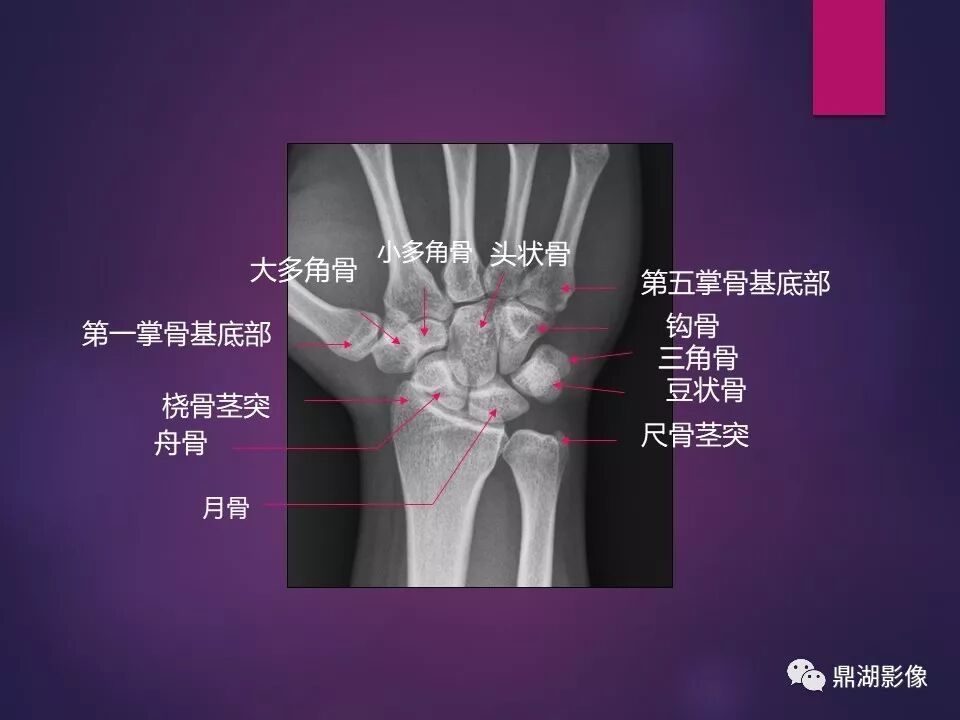 全身骨肌系统正常影像解剖（高清图谱）