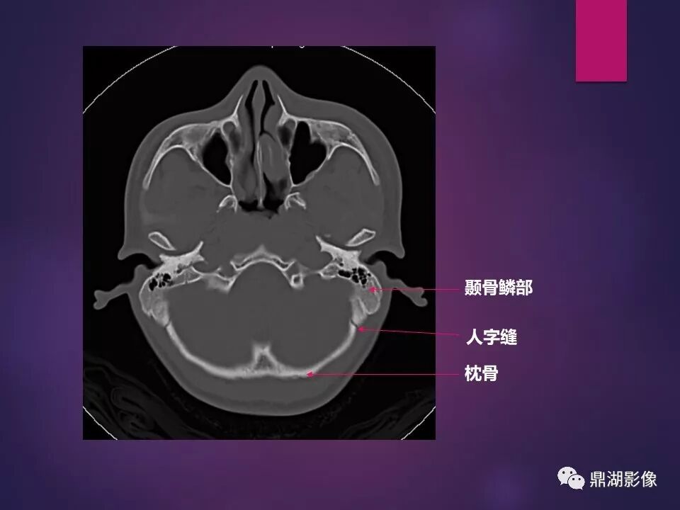 全身骨肌系统正常影像解剖（高清图谱）