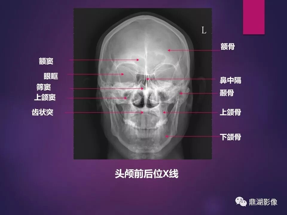 全身骨肌系统正常影像解剖（高清图谱）