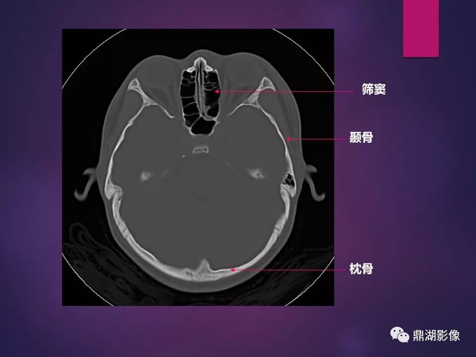 全身骨肌系统正常影像解剖（高清图谱）