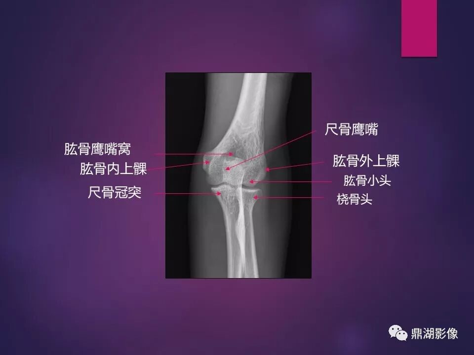 全身骨肌系统正常影像解剖（高清图谱）