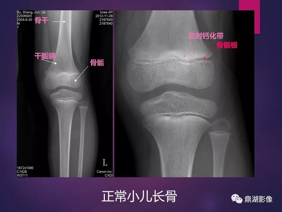 全身骨肌系统正常影像解剖（高清图谱）