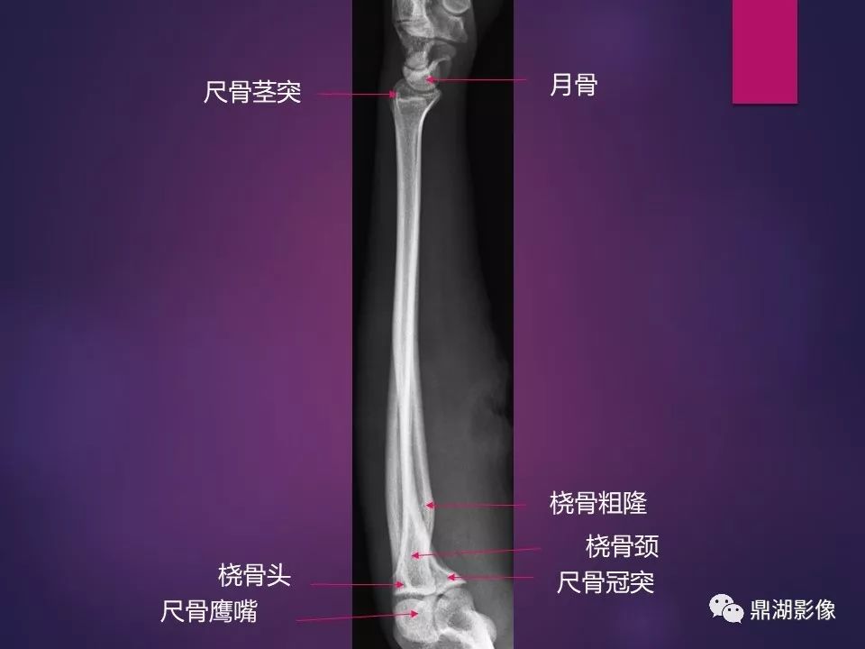 全身骨肌系统正常影像解剖（高清图谱）