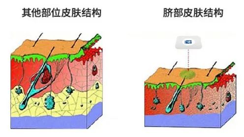 痔疮自愈3个小偏方，不打针、不吃药，坚持1个月以上的人都好了