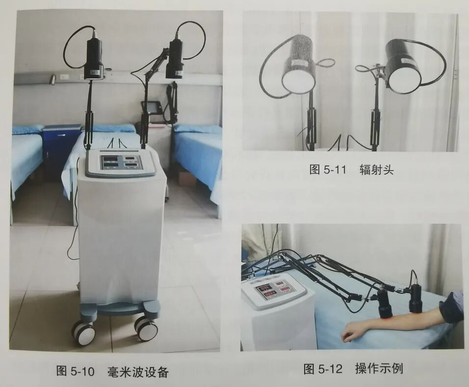 微波怎么治疗微波治疗_https://www.jmylbn.com_新闻资讯_第9张